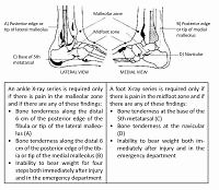 Ottawa Ankle Rules in primary care – awareness, importance and use by family physicians
