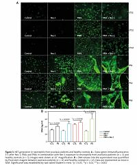RIPK1 downregulation enhances neutrophil extracellular
traps in psoriasis
