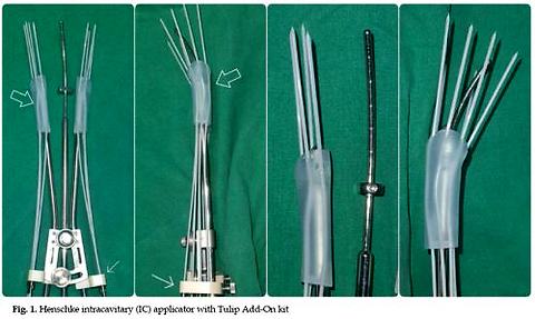 Enhancing brachytherapy in cervical cancer: Initial dosimetric experience and assessment of Tulip hybrid applicator – the Add-On advantage