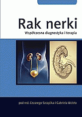 Rak nerki. <br>Współczesna diagnostyka i terapia