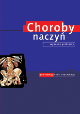Choroby naczyń. Wybrane problemy.