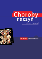 Choroby naczyń. Wybrane problemy