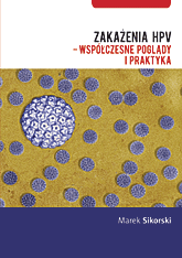 Zakażenia HPV – współczesne poglądy i praktyka