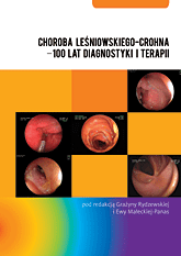 Choroba Leśniowskiego-Crohna – 100 lat diagnostyki i terapii