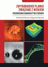 Zwyrodnienie plamki związane z wiekiem – przewodnik diagnostyki i terapii