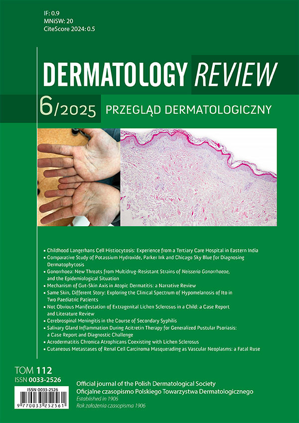 Dermatology Review/Przegląd Dermatologiczny