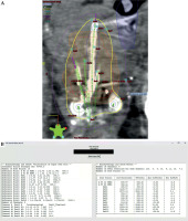 /f/fulltexts/JCB/55496/JCB-16-55496-g004_min.jpg