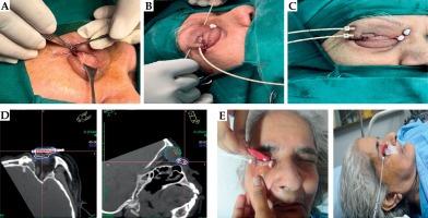 /f/fulltexts/JCB/56379/JCB-17-56379-g001_min.jpg