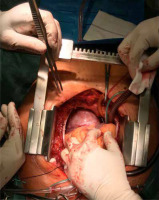 /f/fulltexts/KiTP/50412/KITP-20-50412-g002_min.jpg