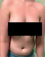 /f/fulltexts/PD/56719/PD-112-56719-g002_min.jpg