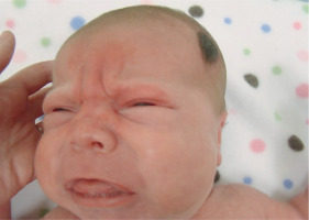 /f/fulltexts/PEDM/57422/PEDM-31-57422-g002_min.jpg