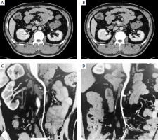 /f/fulltexts/PG/56784/PG-20-56784-g002_min.jpg