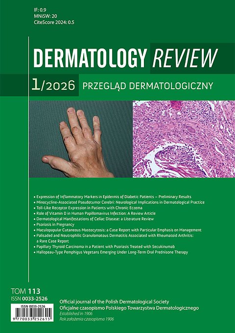 Dermatology Review/Przegląd Dermatologiczny